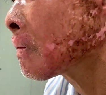 Seo-bong-truoc-pt5